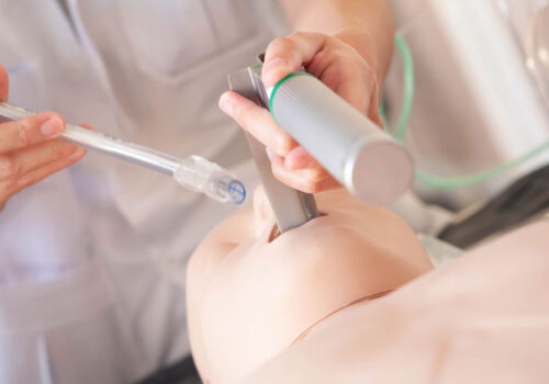 First-pass success rate comparable for inclined vs supine positioning during endotracheal intubation