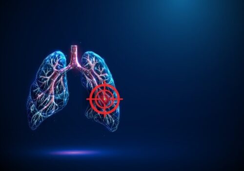 Abstract blue lungs with red human bronchial tree and red target sign to illustrate dupilumab being recommended by NICE as the first targeted treatment for uncontrolled COPD