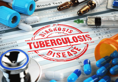 GSK3036656 shows bactericidal activity after 14 days in pulmonary tuberculosis