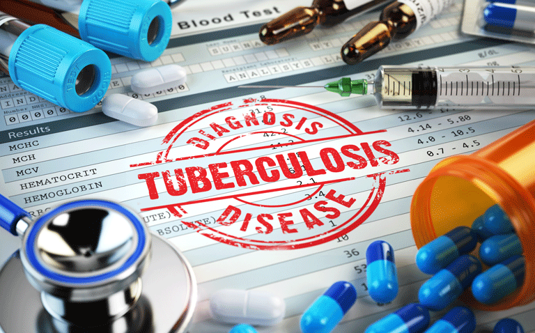 GSK3036656 shows bactericidal activity after 14 days in pulmonary tuberculosis