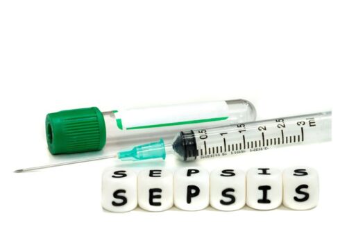 Early intravenous fluid use for sepsis patients in ED improved by range of interventions