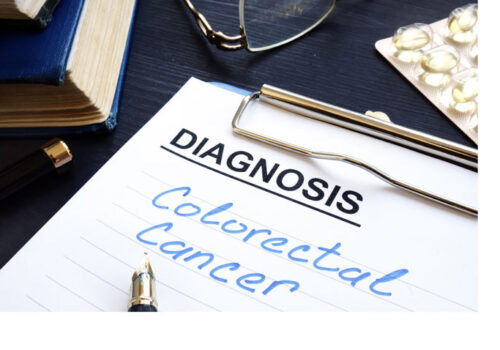 Neoplasia detected in a third of patients under 50 after colorectal screening