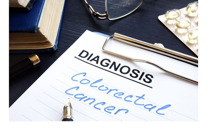 Neoplasia detected in a third of patients under 50 after colorectal screening