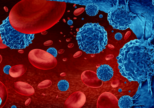 active leukaemia