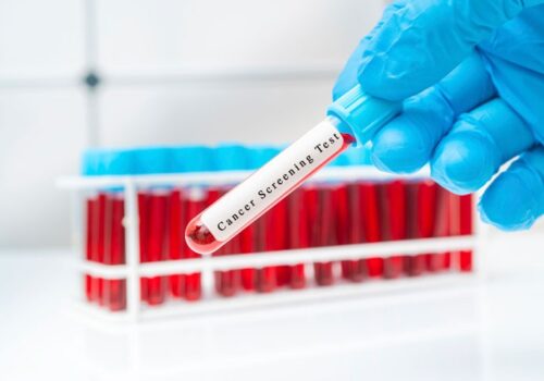 cancer screening