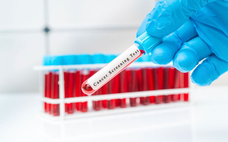 cancer screening