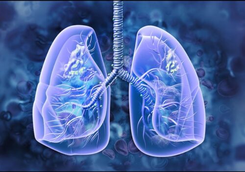 Smoking cessation at time of lung cancer diagnosis associated with improved survival