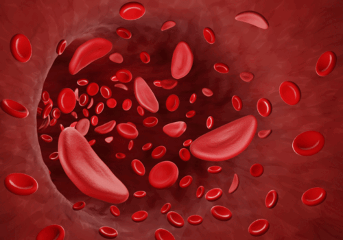 SICKLE CELL covid