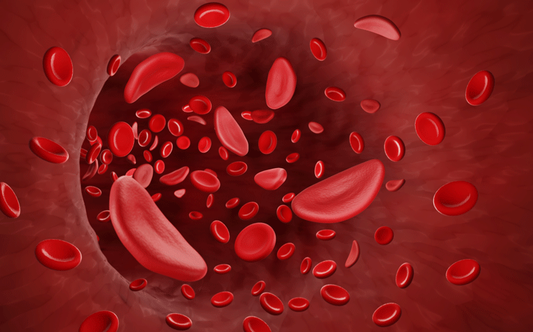 SICKLE CELL covid