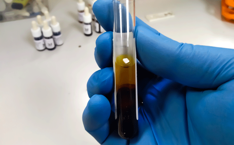 bile acids
