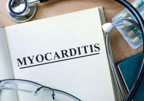 myocarditis