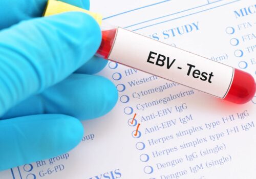 Epstein-Barr virus