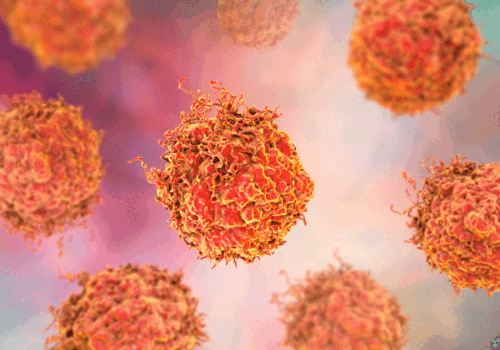 prostate cancer