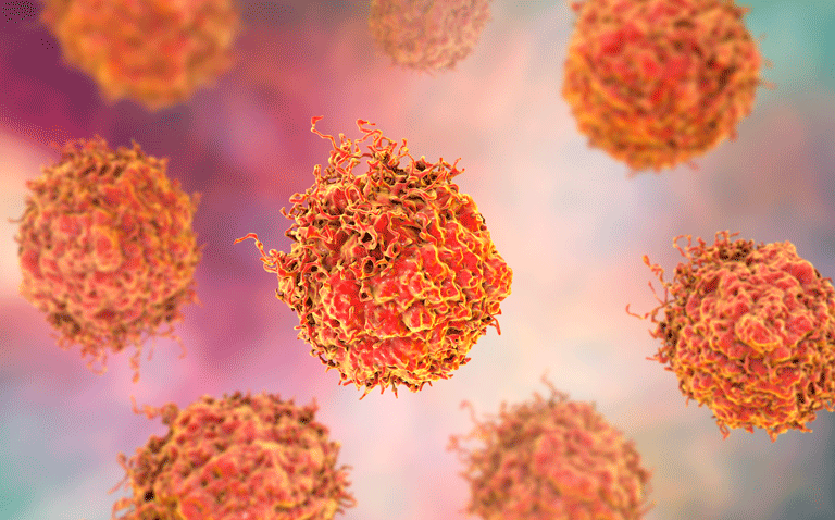 prostate cancer