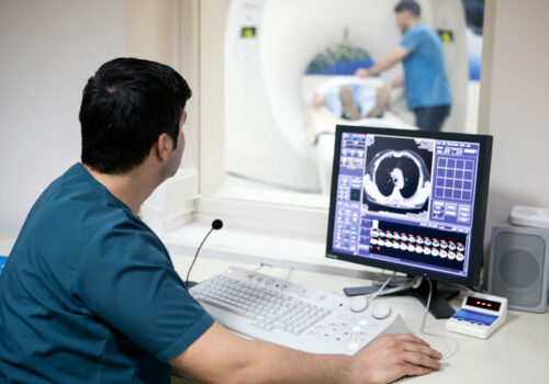 Tau PET scan