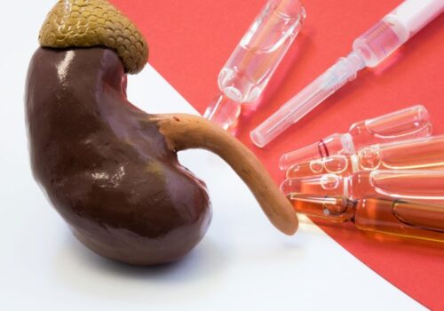 kidney transplant