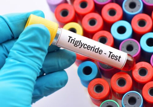 triglyceride test