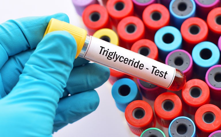 triglyceride test