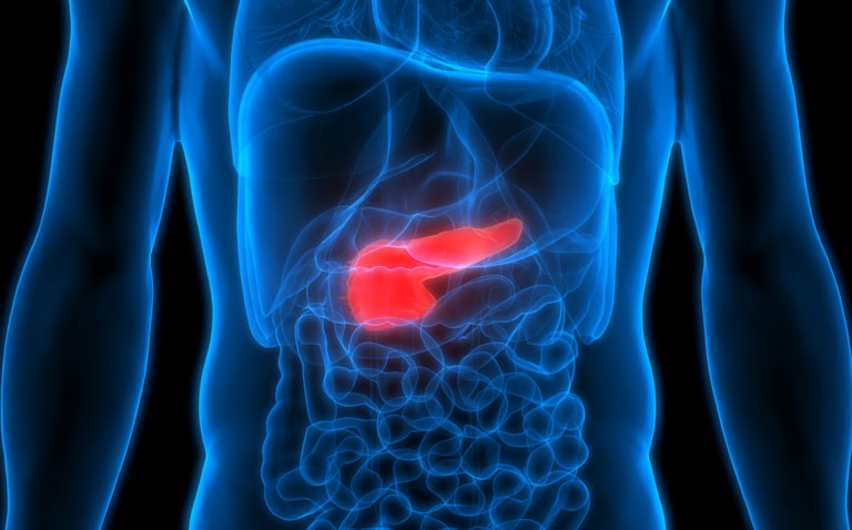 pancreatic cancer