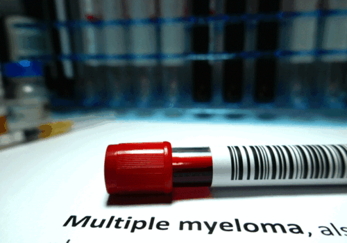 multiple myeloma
