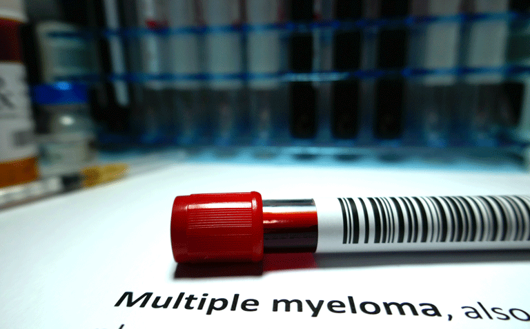 multiple myeloma