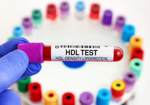 HDL cholesterol protective role questioned