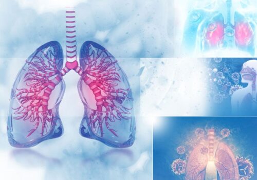 lung cancer services and COVID