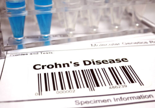Therapeutic drug monitoring of adalimumab in paediatric Crohn's disease