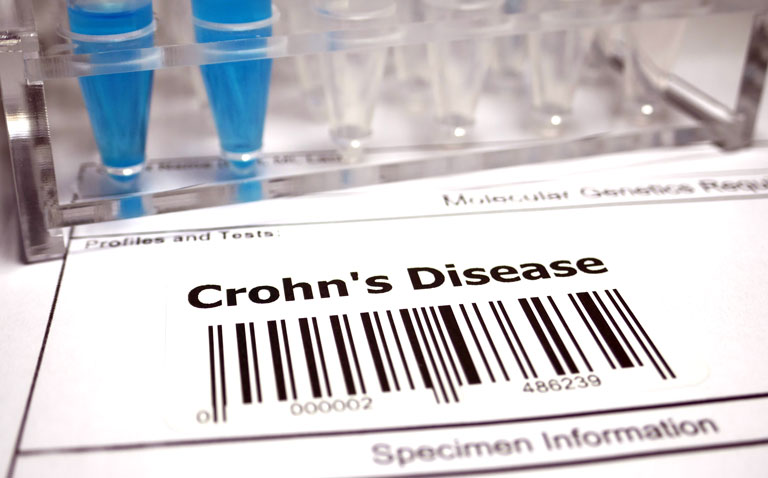 Therapeutic drug monitoring of adalimumab in paediatric Crohn's disease
