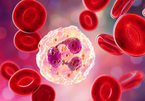 neutrophil activation in severe COVID