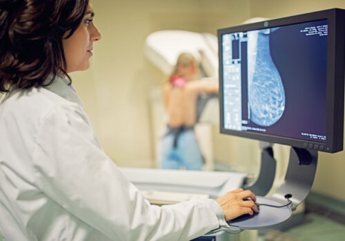 breast cancer screening