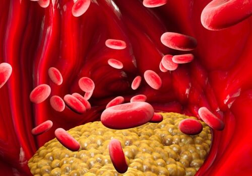 Higher mortality linked to greater intake of eggs and cholesterol-rich food