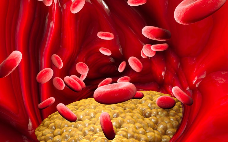 Higher mortality linked to greater intake of eggs and cholesterol-rich food
