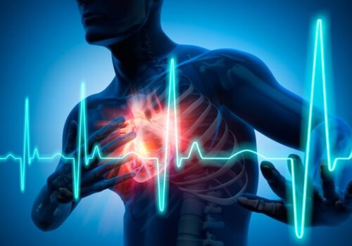 Use of advanced machine learning models does not appear to improve post-MI mortality risk prediction