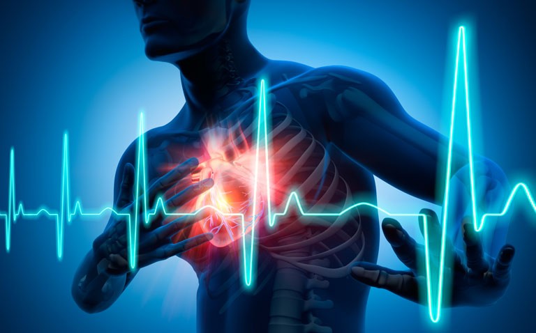 Use of advanced machine learning models does not appear to improve post-MI mortality risk prediction