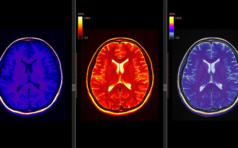cannabis use and neurodevelopment