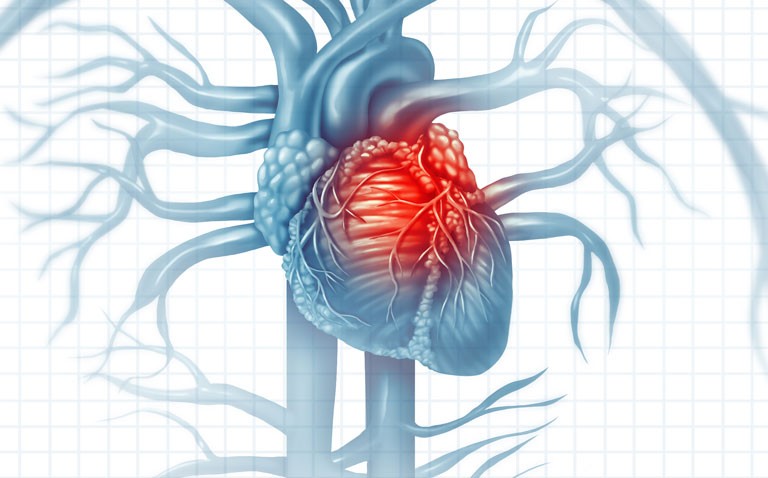 CHD and working hours