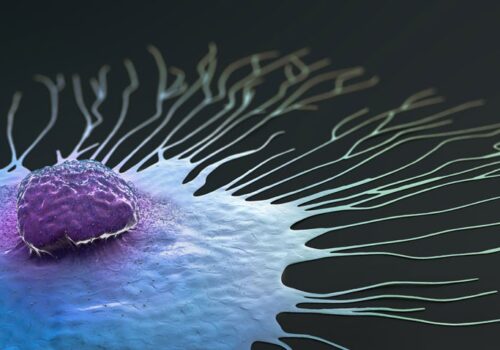 breast cancer in women