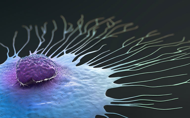 breast cancer in women