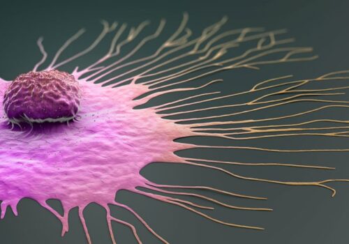 Higher BMI and risk of second breast cancer