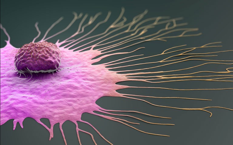 Higher BMI and risk of second breast cancer