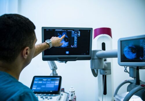 mammography