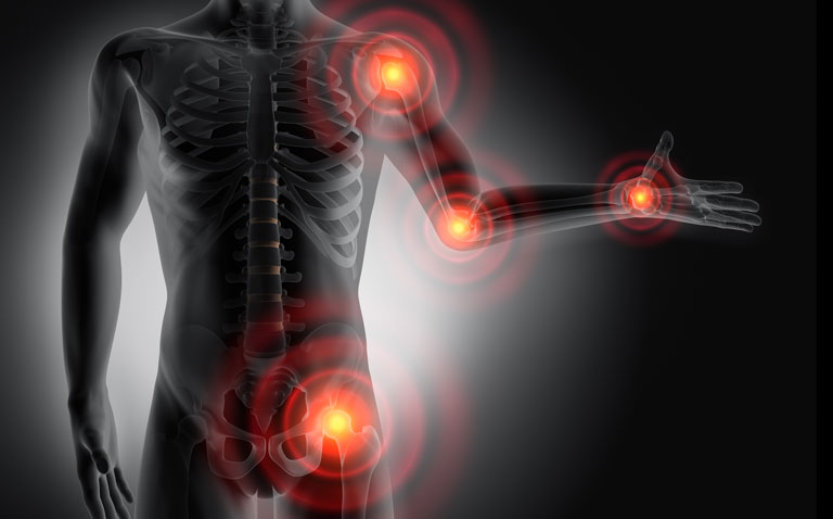 Beta-blockers associated with analgesic effect in osteoarthritis