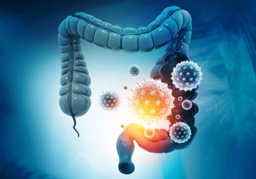 GI symptoms and impact in COVID