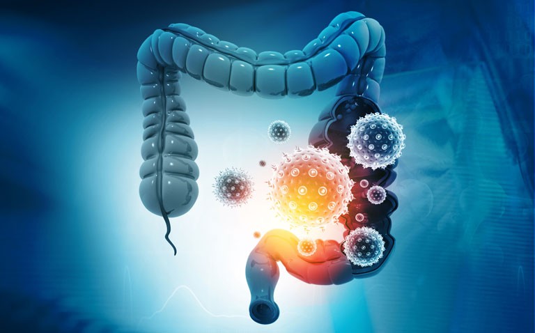 GI symptoms and impact in COVID