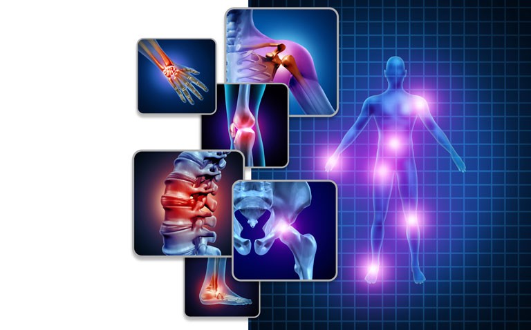 Risankizumab receives MHRA approval for psoriatic arthritis