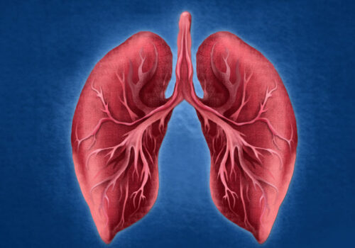 Increased anxiety among asthmatics a risk factor in disease worsening during COVID-19