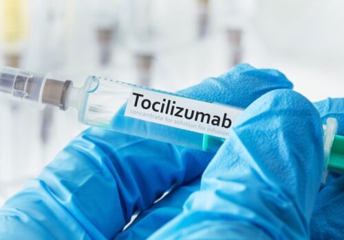 ocilizumab in severe COVID