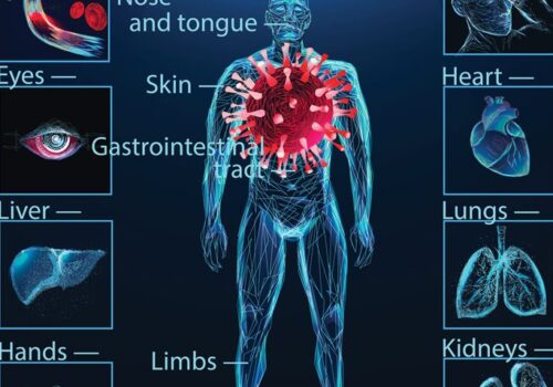 covid complications