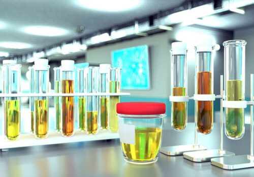 microRNAs as biomarker for brain tumours|microRNA biomarker for brain tumour
